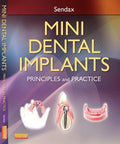 Mini Dental Implants: Principles and Practice [Hardcover] Sendax, Victor Dr.